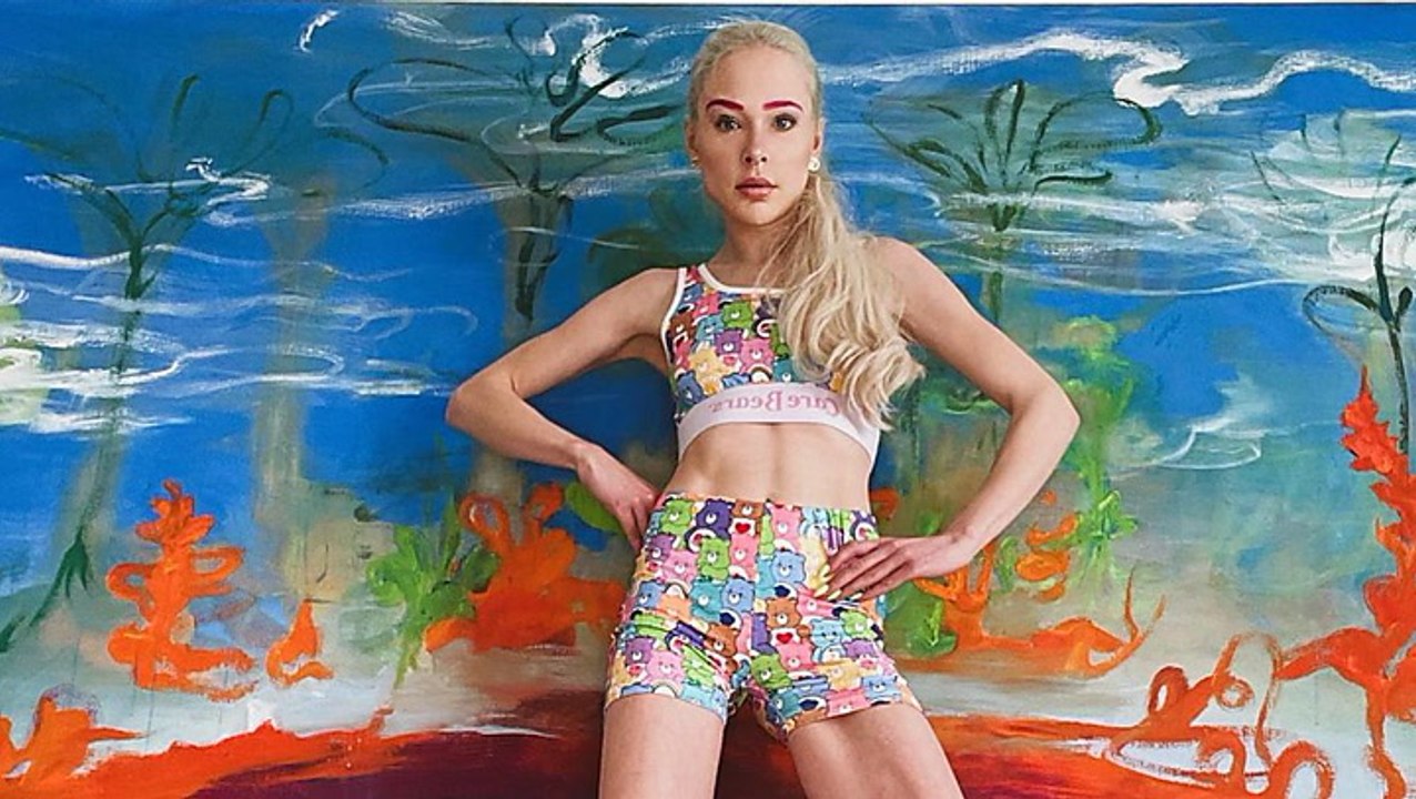 GNTM Theresia Fischer: Der traurige Grund für Bein-Verlängerung