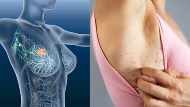 बगल में खुजली क्यों होती है | Bagal Mein Khujli Kyu Hoti Hai | Boldsky