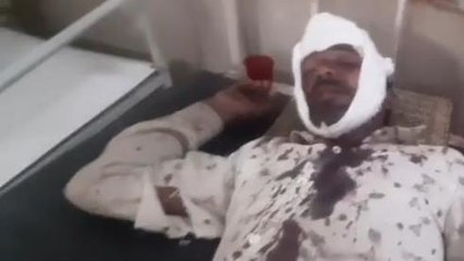 गुना:भैंस चोरों ने दंपति को मारी कुल्हाड़ी,किया लहूलुहान