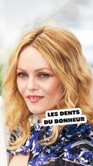 Mais pourquoi appelle-t-on les dents du bonheur les dents du bonheur ? 