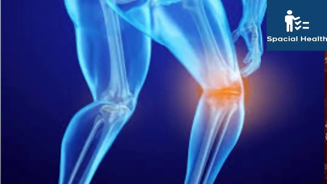 Uric Acid Treatment in Urdu Uric Acid Ka Sasta Nuskha Uric Acid Ka Ilaj 2023