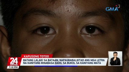 Batang lalaki sa Bataan, napagbabaliktad ang mga letra na kaniyang binabasa dahil sa bukol sa kaniyang mata | 24 Oras