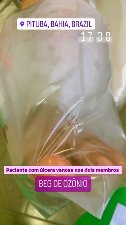 CuraLife - Procedimentos Pt. 3