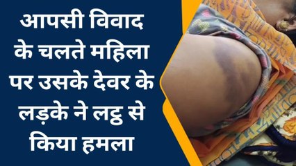 भीलवाडा : आपसी विवाद के चलते महिला पर किया हमला, देखिए खबर