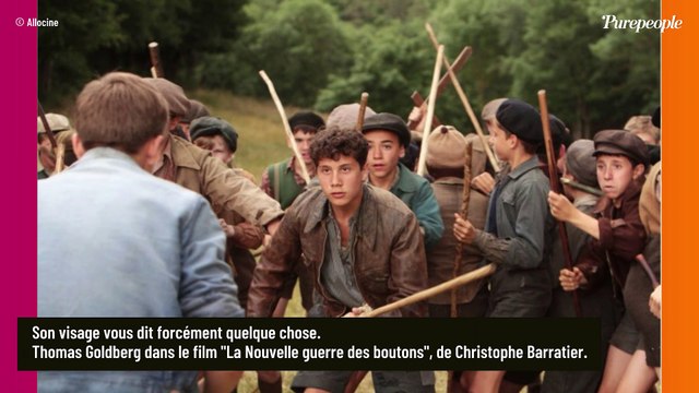 Thomas Goldberg : Alcoolisme, dépression, l'ancien héros de la Guerre des boutons a vécu l'enfer