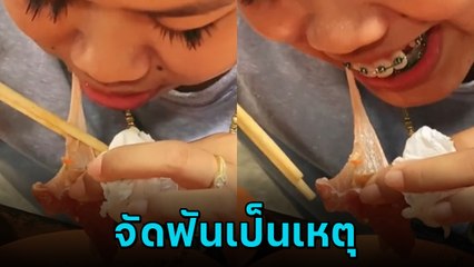 ไวรัล 7 ล้าน ! เตือนภัยคนจัดฟัน กินบุฟเฟต์ทุลักทุเลกว่าที่คิด