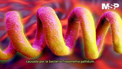 Los efectos de la sífilis en el cuerpo - #ExclusivoMSP