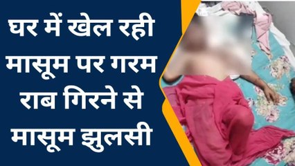भीलवाडा : घर में खेल रही मासूम पर गरम राब से भरी तपेली गिरी