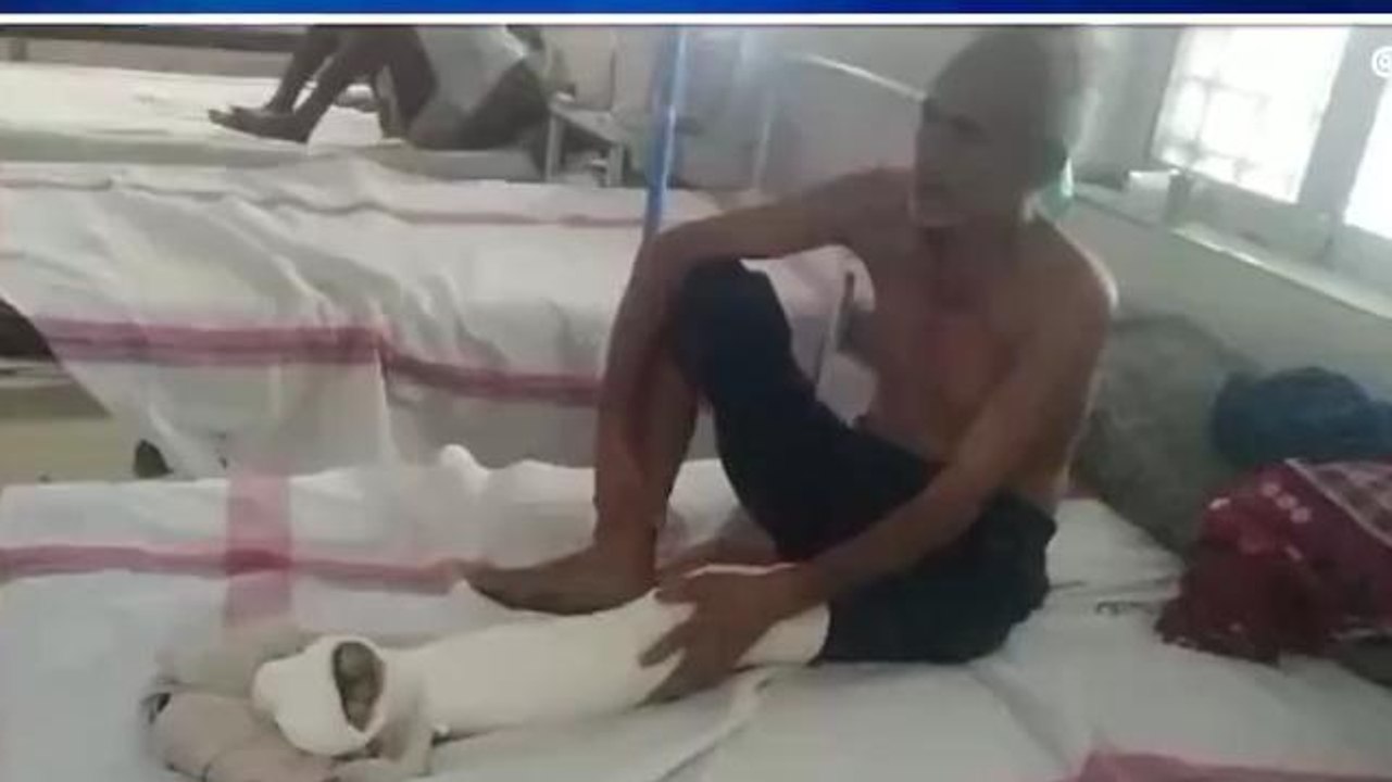 सीधी: आवारा मवेशी के हमले से बुजुर्ग व्यक्ति हुआ गंभीर रूप से घायल