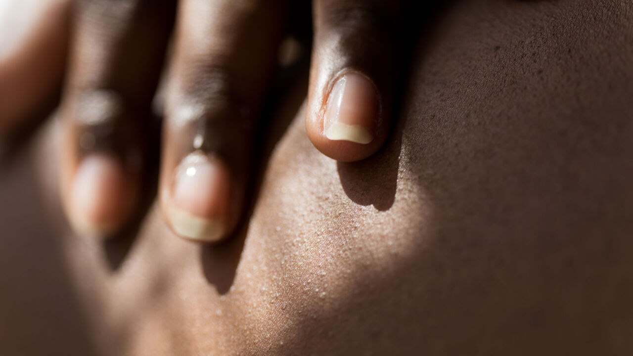 8 Simple Nail Care Tips to Banish Dry, Brittle Nails for Good