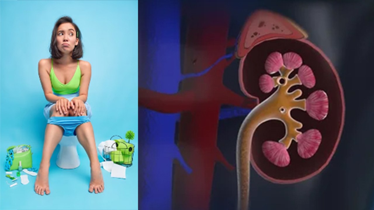 Silent Kidney Stones क्या है, Symptoms नजरअंदाज करने पर Kidney Damage | Boldsky