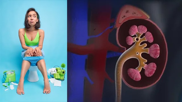 Silent Kidney Stones क्या है, Symptoms नजरअंदाज करने पर Kidney Damage | Boldsky