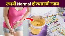 लघवीला आग होते? | Urinary Tract Infection | Urinary Tract Infection Causes | Lokmat Sakhi | AI2