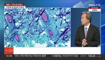 [뉴스현장] '엠폭스' 사흘새 10명 발생…지역사회 전파 본격화 하나