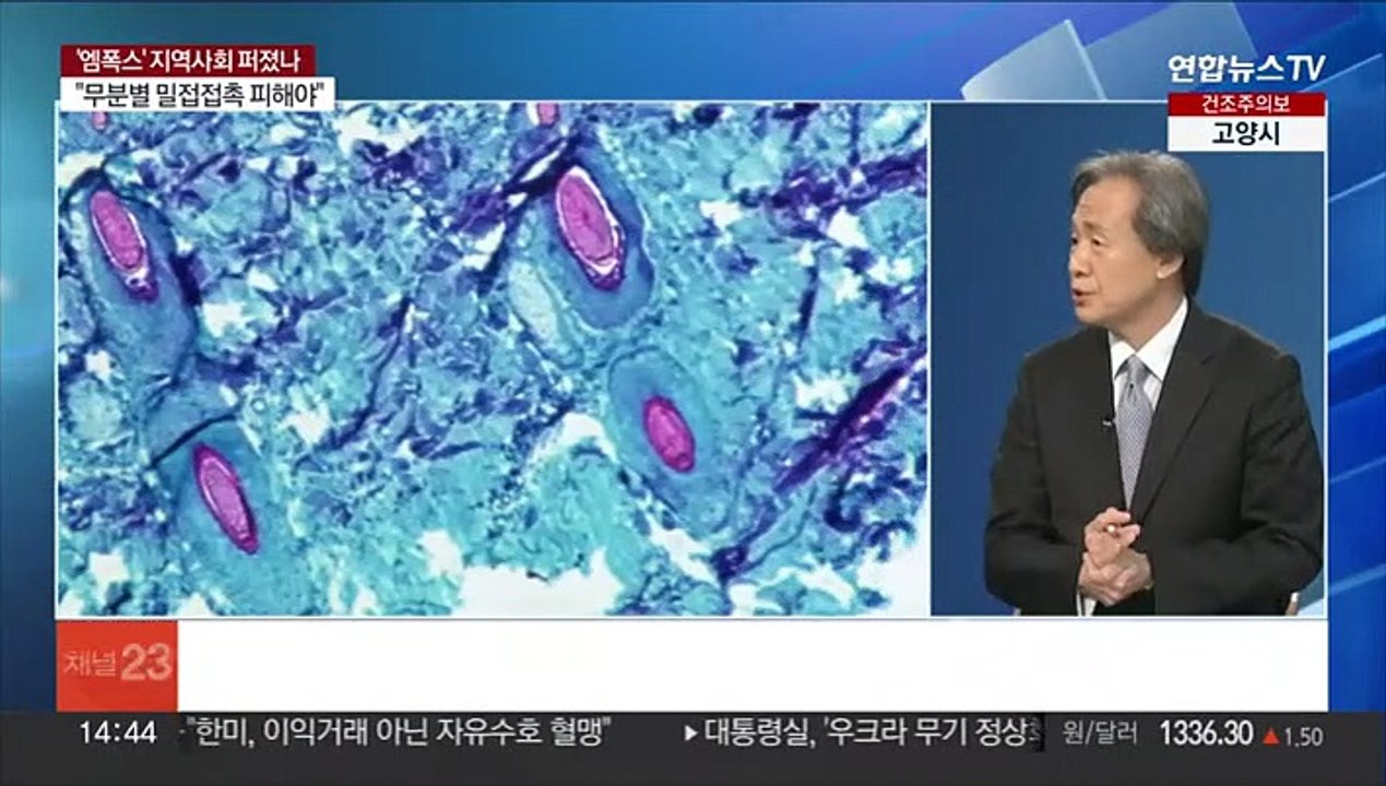 [뉴스현장] '엠폭스' 사흘새 10명 발생…지역사회 전파 본격화 하나