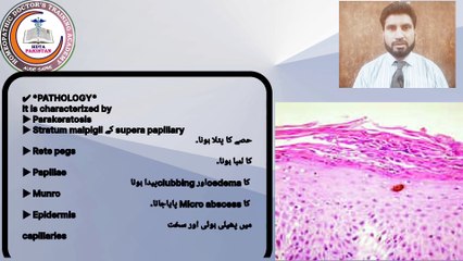 chambal ka homoeopathic ilaj