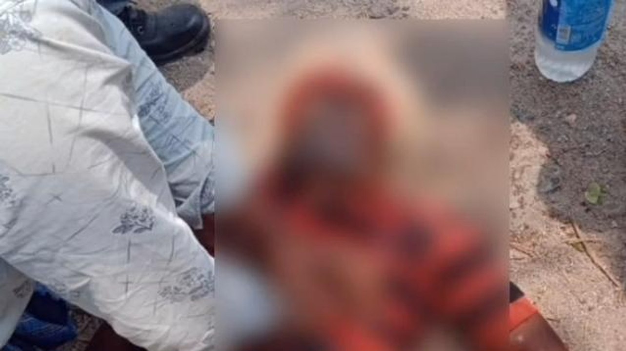 మానకొండూర్: జిల్లాలో ఘోర రోడ్డు ప్రమాదం.. వ్యక్తికి తీవ్ర గాయాలు