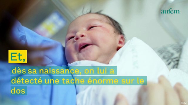 Bébé tortue ninja : cet enfant de 2 ans est atteint d'une maladie de la peau très rare
