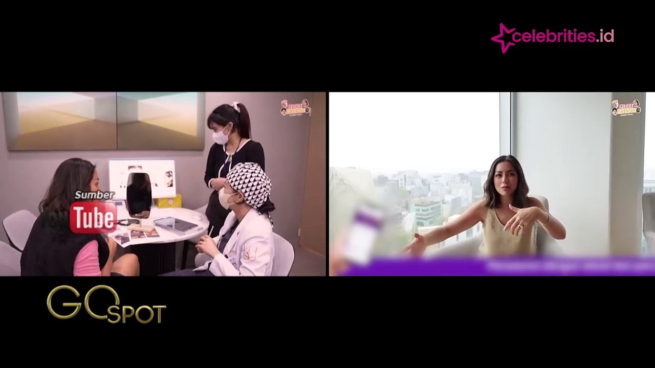 Jessica Iskandar Ungkap Alasan Utama Lakukan Oplas