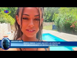 Jessica Errero (LAA6) raconte les séquelles  son empoisonnement et dévoile les photos