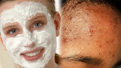 चेहरे पर मलाई लगाने से क्या होता है । जानें रात को चेहरे पर मलाई लगाने के फायदे । Boldsky