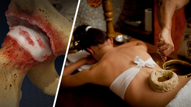 Haddi Galne Ka Ilaj | हड्डी गलने का इलाज | Haddi Galne Ka Karan | हड्डी गलने का कारण | Boldsky