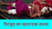 रामपुर: 6 साल के बच्ची पर कहर बनकर टूटा पिटबुल कुत्ता, पूरे शरीर पर लगे दर्जन भर टांके