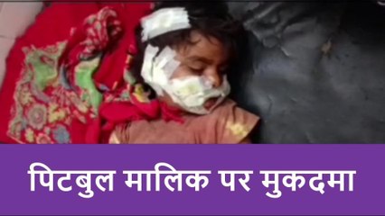 रामपुर: मासूम बच्ची पर हमला करने वाले वाले पिटबुल डॉग के मालिक के विरुद्ध रिपोर्ट दर्ज