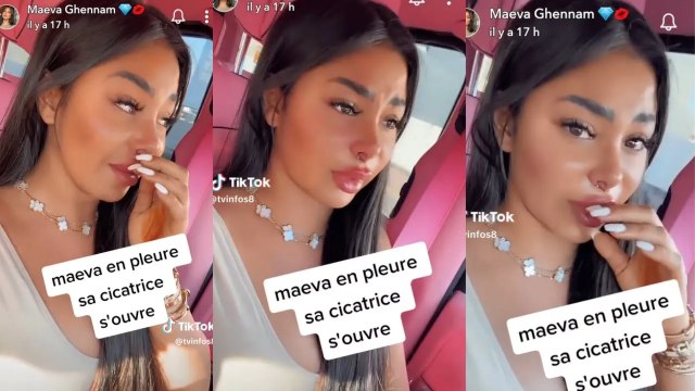 Maeva Ghennam en larmes ses lèvres pour sa dernière opération du nez qui vire au cauchemar