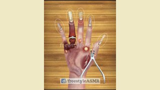 ASMR Hand Treatment Removal of Maggot Worms Insects, Bugs and Glasses | #amsr #animation