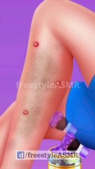 ASMR Leg Treatment and Beautification | #shorts #amsr #animation