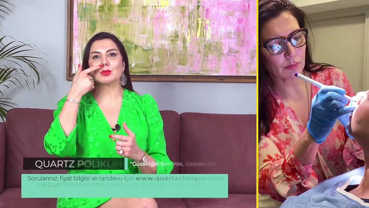 Lip Lift Dudak Asimetrisi Nasıl Düzeltilir? |  Op. Dr. Leyla ARVAS