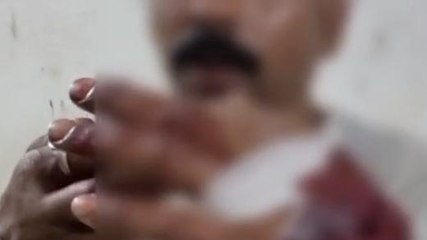 শালবনী :দু টাকার গ্লাসের জন্য ছুরি চালালো একদল যুবক