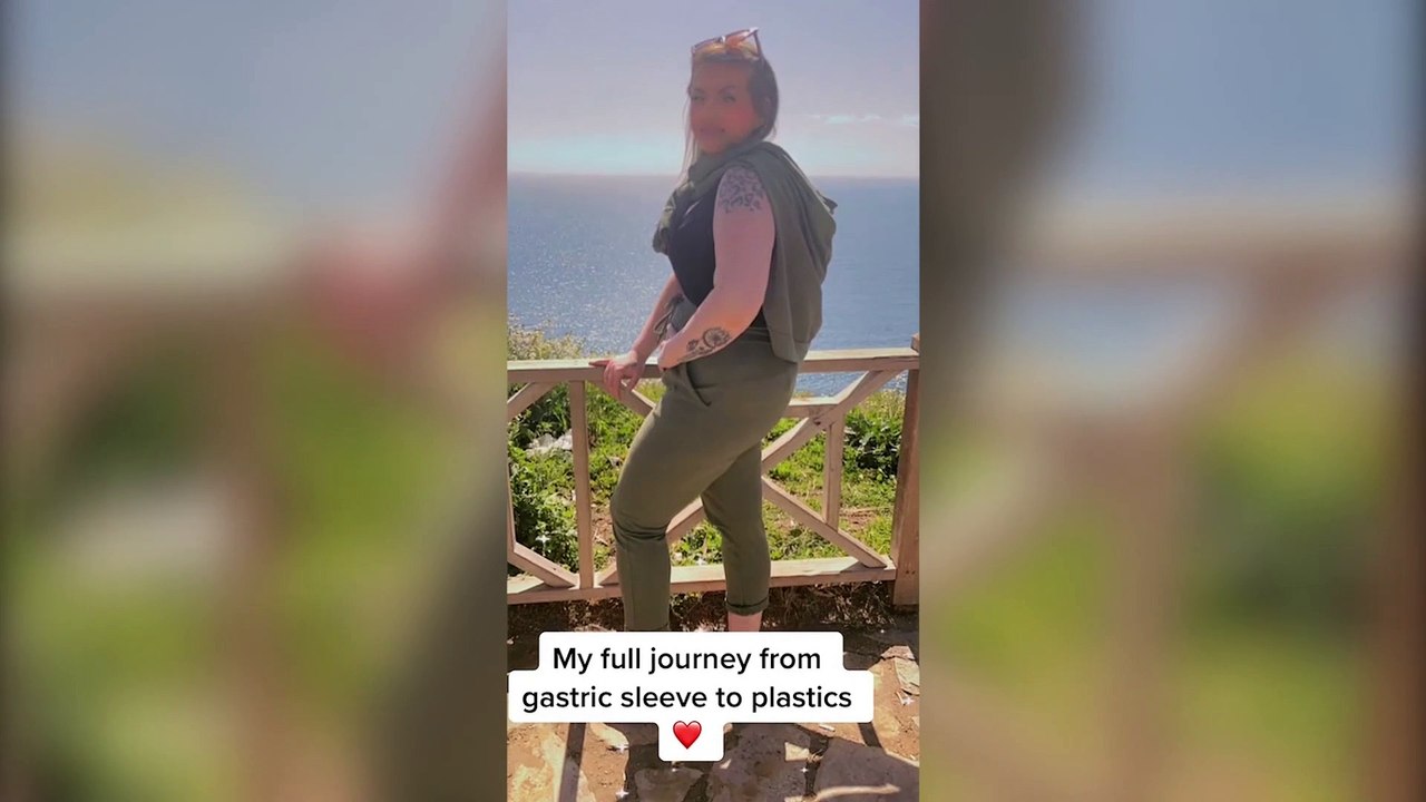 A woman claims she was "butchered" by a Turkish surgeon who she claim let her right breast die and left her with gaping wounds on her stomach