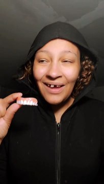 Instant Smile teeth Veneers