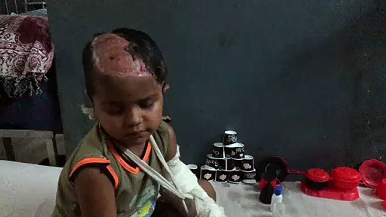 एमबीएस अस्पताल के डॉक्टरों ने एक बार फिर कमाल क...