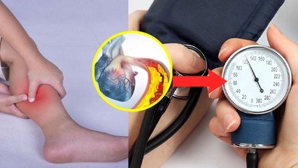 High Bp में Leg Pain क्यों होता है | हाई बीपी में पैरों में दर्द होने का कारण जानकर चौंक जाएंगे