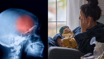 Postpartum Depression क्या है, Symptoms Reason और Treatment | Boldsky