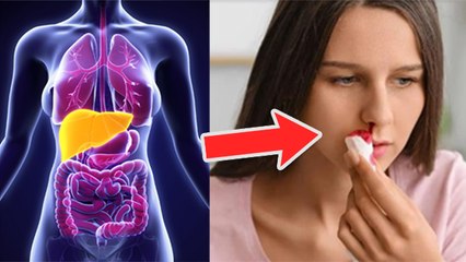 नकसीर फूटने के कारण Fatty Liver Symptoms, Epistaxis Causes Reason जानना जरूरी | Boldsky