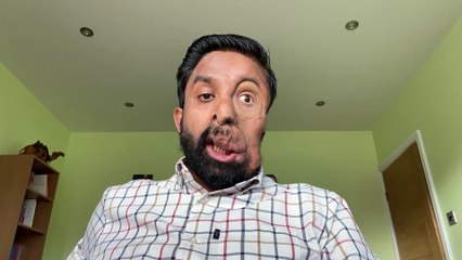 Man with facial disfiguration left "disheartened" after AI software fails to recognise him