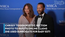 Chrissy Teigen Posts C-Section Photo to Refute Online Claims She Used Surrogate for Baby Esti