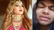 Rakhi Sawant ने कराई Lips  और Face की Surgery, Video देख चौंके Fans बोले-ये क्या है...| FilmiBeat