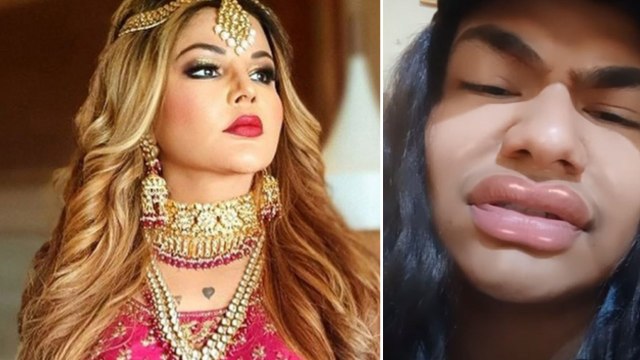 Rakhi Sawant ने कराई Lips और Face की Surgery, Video देख चौंके Fans बोले-ये क्या है...| FilmiBeat