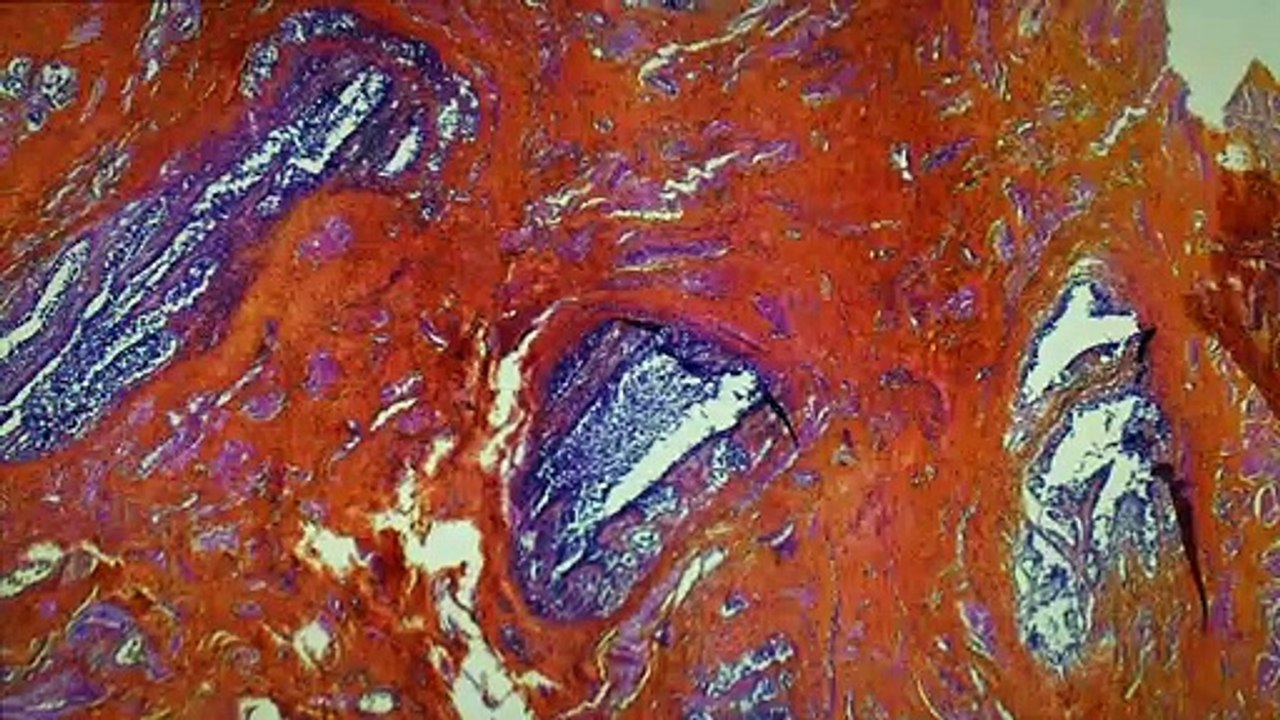 De humani corporis fabrica trailer ov