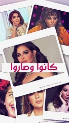 ليالى دهراب لجأت لعمليات التجميل وهي لا تزال بعمر العشرينات