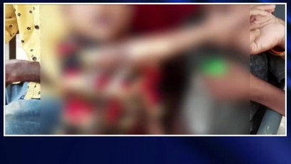 উত্তর ২৪ পরগনা: দুটি বাইকের মুখোমুখি সংঘর্ষ! গুরুতর আহত এক শিশু সহ মহিলা