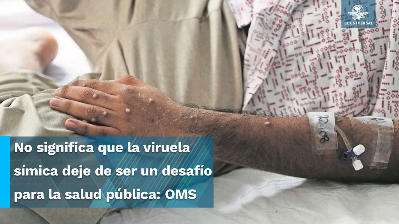 Declaran fin de la emergencia por la viruela del mono o símica