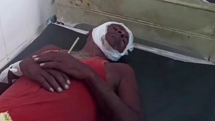 मुंगेर: जमीन विवाद को ले हुई झड़प में युवक को पीट किया अधमरा ,ईलाज जारी