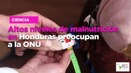 Altos niveles de malnutrición en Honduras preocupan a la ONU