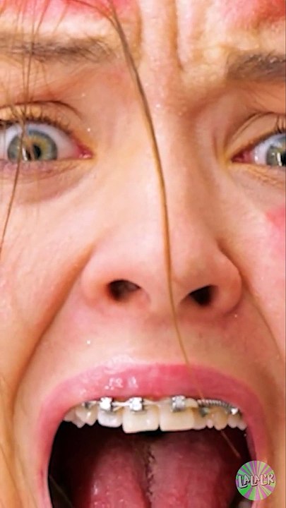 J'ai perdu mes SOURCILS ! !!  Problèmes de beau...